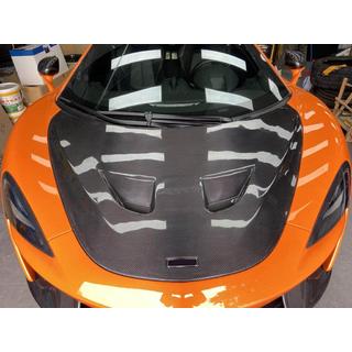 Kapota (karbón) McLaren 540C/570S 2015–2020 fotografia 2